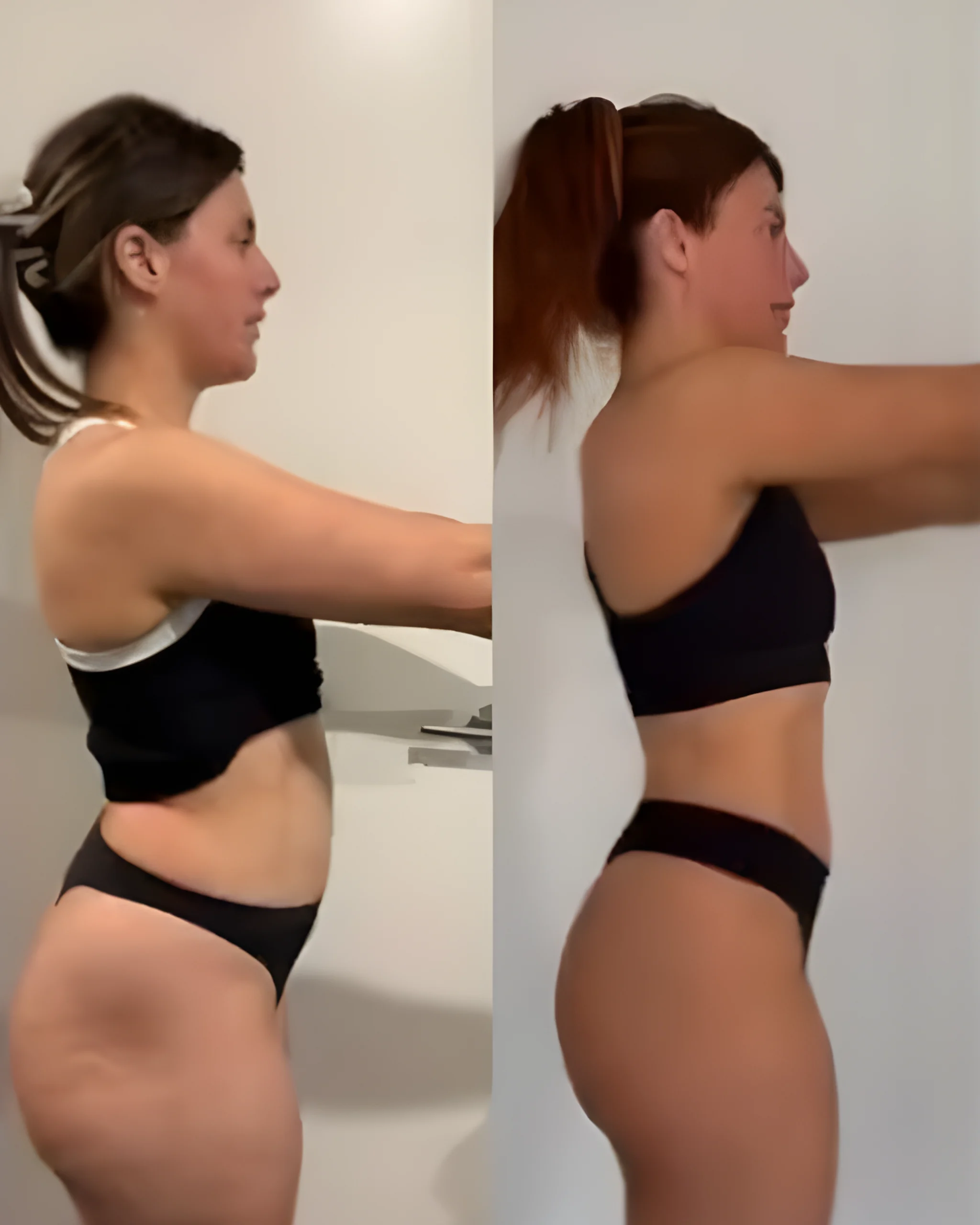 Michelle Front View Transformation